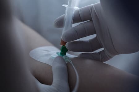 Improper Placement of IV Causes Fluid Leakage Under the Skin and Severe Skin Irritation