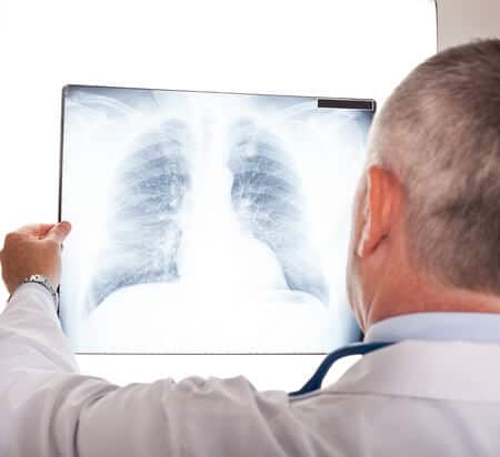 Rare Complication of Lung Biopsy Results in Patient’s Death