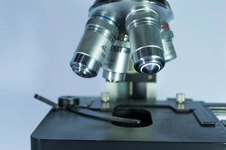 Delayed Diagnosis of Invasive Bladder Cancer