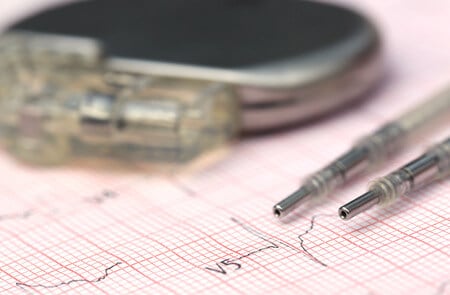 Patient Dies After Being Sent Home With Dysfunctional Pacemaker