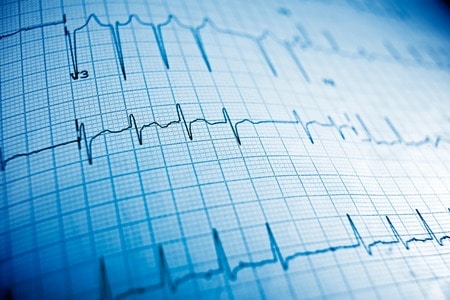 Patient Sent Home With Classic Signs of Heart Attack