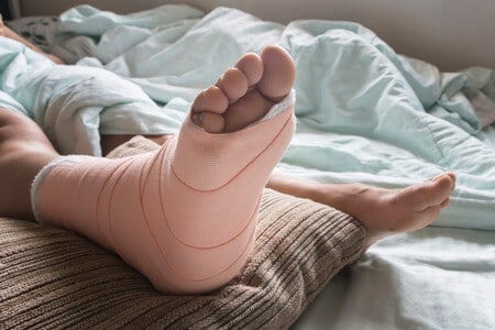 Delayed Diagnosis of Septic Joint After Ankle Surgery