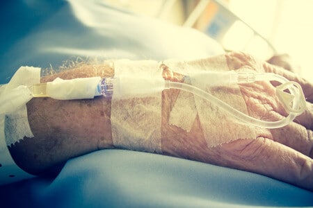 Delayed Treatment of Stroke Results in Untimely Death