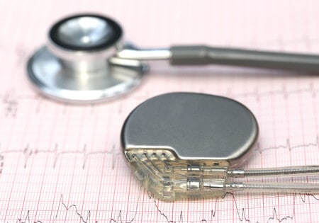 Surgeon Does Not Secure Leads During Pacemaker Placement