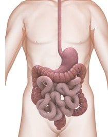 Gastroenterology Expert Witness Comments on Effects of Remicade