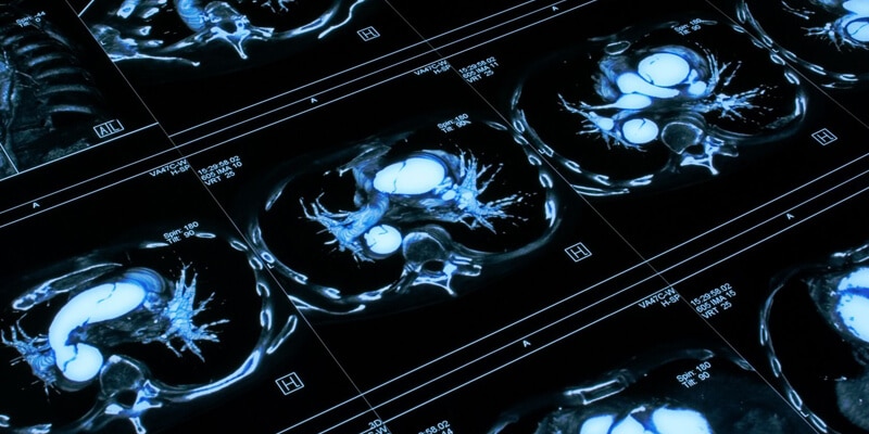 Radiation Oncology Expert Witness discusses Medical Malpractice