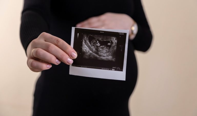 Laboratory Mistake Yields Inaccurate Report for Woman Pregnant With Down Syndrome Baby