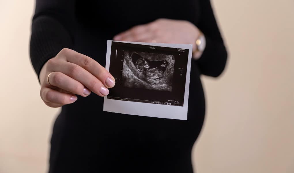 Laboratory Mistake Yields Inaccurate Report for Woman Pregnant With Down Syndrome Baby