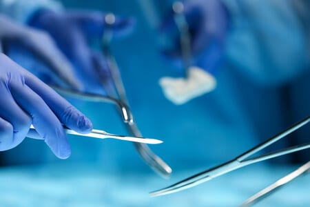 Synthetic Mesh Defect and Migration Causes Severe Abdominal Infection and Fistula Formation