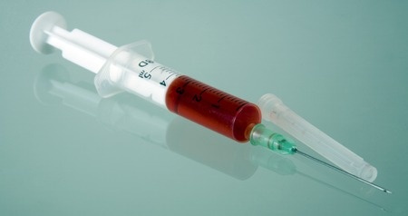 Hysterectomy via Da Vinci Robotic Surgery Causes Severe Postoperative Issues