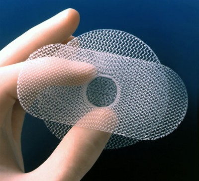 Vaginal Mesh Implant Results in Severe Health Complications