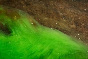 Neurology Expert Witness