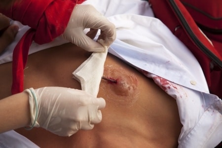 Patient Develops Necrotizing Infection in Hospital