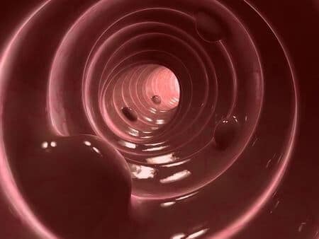 Doctors Fail to Remove Suspicious Polyps