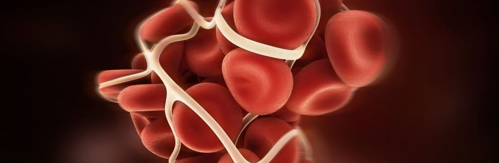 C.R. Bard IVC MDL Nearing Trial Date