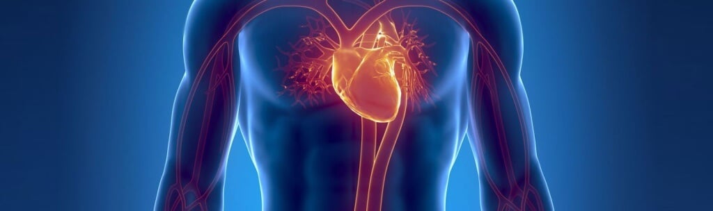 IVC Filters – A Litigation Guide