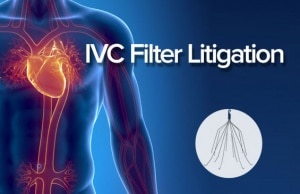 IVC Filter Litigation Guide
