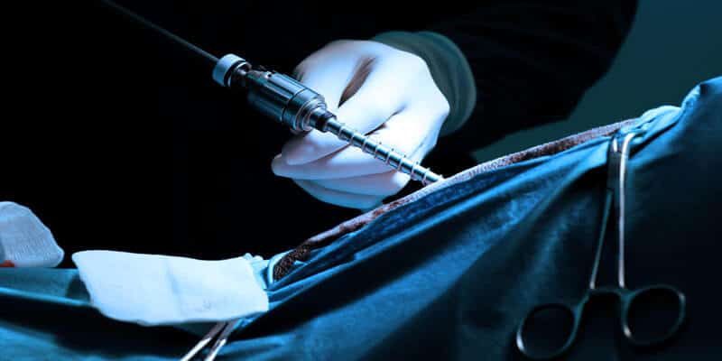 40 More Plaintiffs Ready to Join Morcellator MDL