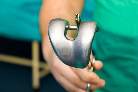 Bone Cement Named as Likely Cause of Prosthesis Failure by Polymer Expert Witness