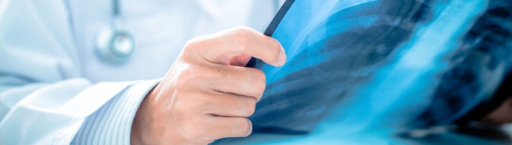 Pulmonary Embolus in the Hospital Setting – A Primer for Attorneys