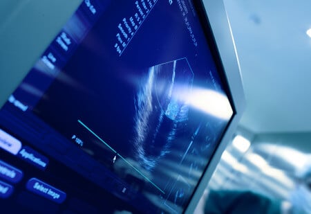 Vascular Surgery Patient Experiences Severe Stroke During Procedure