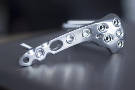 Biomedical Engineering Experts Discuss Failure of Carbon Fiber Fixation Device