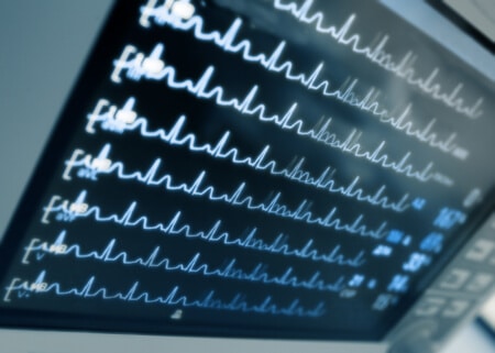 Improper Placement of Nasogastric Tube Leads to Patient Death