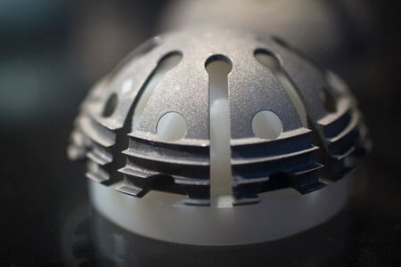 Biomechanical Engineering Expert Discusses Catastrophic Failure of Hip Implant