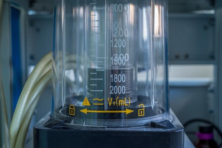 Sleep Apnea Patient Suffers Stroke Following Neck Surgery