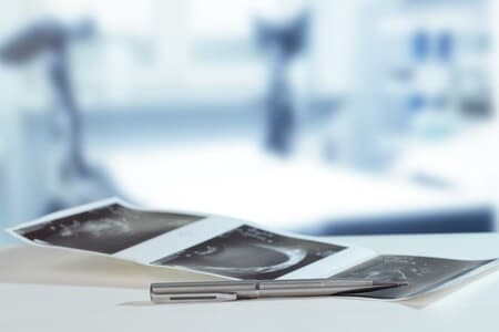 Tumor Removal Complicates Pregnancy