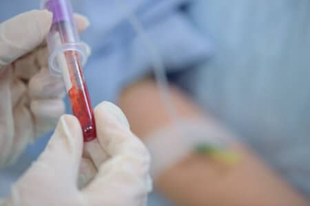 PSA Testing Expert Discusses Prostate Cancer Protocol