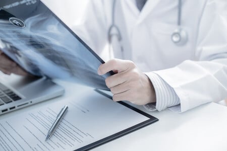 Patient Dies Of Liver Failure After Delayed Interventional Radiology Treatment