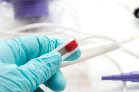 Patient Discharged From Hospital With Dislodged Feeding Tube