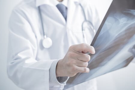Diagnostic Radiologist Fails To Recognize Advanced Spinal Cancer