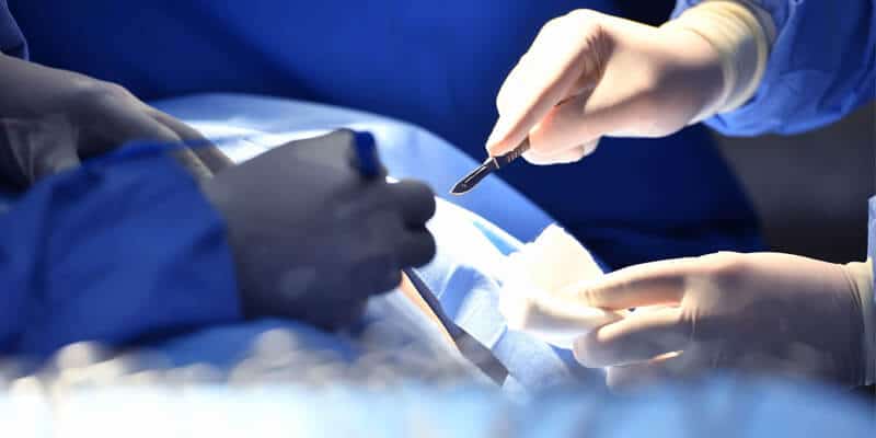 Johnson & Johnson Subsidiary Must Pay Prolift Mesh Damages Award