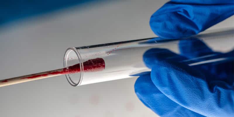 "The Staircase" Expert