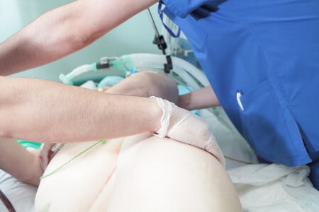 Patient Develops Bacterial Infection From Untreated Bedsore