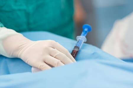 Radiologist Pierces Patient’s Aorta Causing Fatal Bleed Out