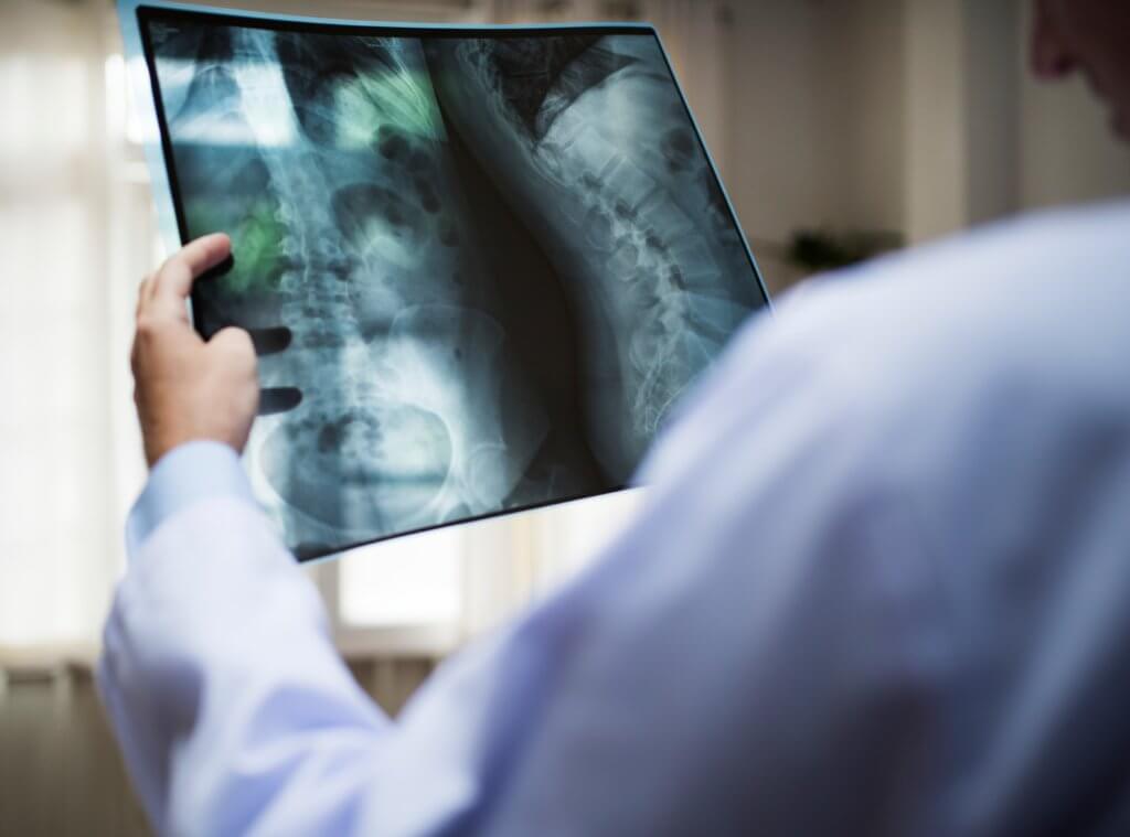 How Safe is the Total Posterior Spine (TOPS) System?