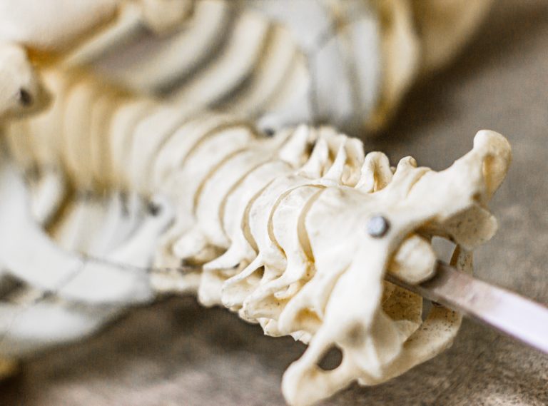 Court Deems Neurosurgery Expert’s Opinion Relevant Despite Reliance on Irrelevant Scientific Literature