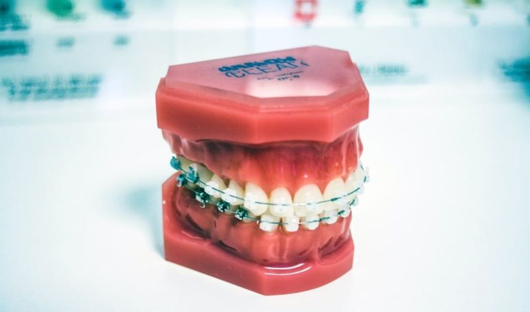 Dentistry Expert Witness’s Opinion Admissibility Depends on Reliance on Other Expert’s Opinion