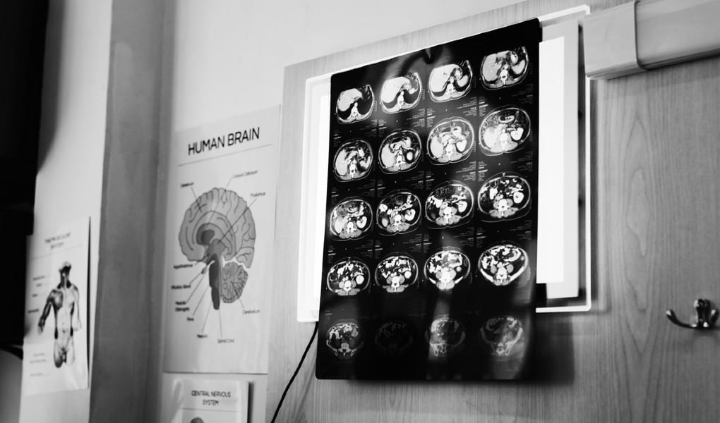 Expert Witness Research, Preparation Leads to Verdict for Plaintiff